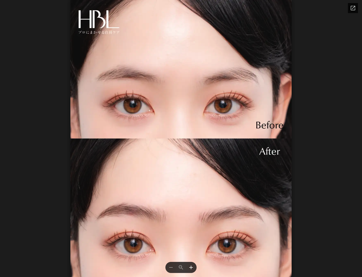 ビフォーアフター1